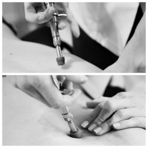 activator activateur chiropraxie chiropracteur colonne soin ajustement annecy