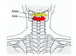 anatomie C1 C2 atlas axis crane colonne rachis cervical