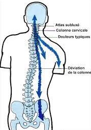 atlas-subluxation-chiropracteur-cervicale